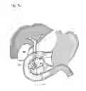 Fig. 33 - Treatment method