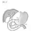 Fig. 34 - Treatment method