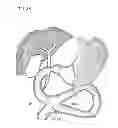 Fig. 44 - Treatment method