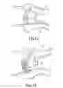 Fig. 08 - SPECULUM