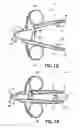 Fig. 10 - SPECULUM