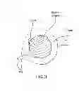 Fig. 04 - Method and composition for hyperthermally treating cells