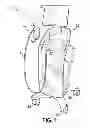 Fig. 02 - Ultrasonic transducer