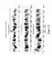 Fig. 40 - REMOTE AND LOCAL TRANSFER OF INFORMATION IN NONINVASIVE HYDRATION MEASUREMENTS