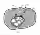 Fig. 06 - Method and Systems for Delivering and Deploying a Sensory Implant In Situ