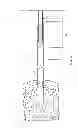 Fig. 09 - Methods and devices for removing tissue from a patient