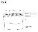 Fig. 04 - BODY FLUID COLLECTION DEVICE