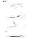 Fig. 08 - BODY FLUID COLLECTION DEVICE