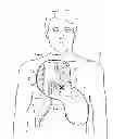 Fig. 01 - Cardiac resuscitation with prompting and defibrillation in separate units and with an activity sensor for detecting patient initiated movement