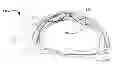 Fig. 01 - A CARDIO PULMONARY RESUSCITATION DEVICE AND AN INTEGRATED RESUSCITATION SYSTEM THEREOF