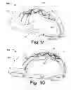 Fig. 11 - A CARDIO PULMONARY RESUSCITATION DEVICE AND AN INTEGRATED RESUSCITATION SYSTEM THEREOF