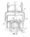 Fig. 20 - Reversibly engaged force-controlled buckle and pelvic ring support device incorporating such a buckle