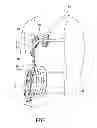 Fig. 02 - Thoracic lumbar sacral orthosis