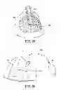 Fig. 09 - Thoracic lumbar sacral orthosis