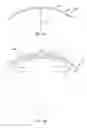 Fig. 06 - EYE COVERINGS FOR CORNEAL HEALING AND METHODS OF USE