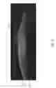 Fig. 32 - EYE COVERINGS FOR CORNEAL HEALING AND METHODS OF USE