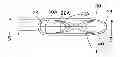 Fig. 01 - CATHETER