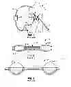 Fig. 02 - Recovery catheter assembly