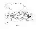 Fig. 03 - Recovery catheter assembly