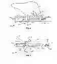 Fig. 07 - Recovery catheter assembly