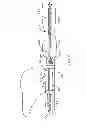 Fig. 08 - Recovery catheter assembly