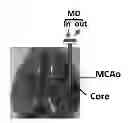 Fig. 01 - METHOD FOR TREATING BRAIN INJURY OR STROKE