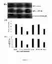 Fig. 03 - METHOD FOR TREATING BRAIN INJURY OR STROKE