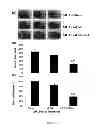 Fig. 04 - METHOD FOR TREATING BRAIN INJURY OR STROKE