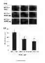 Fig. 13 - METHOD FOR TREATING BRAIN INJURY OR STROKE