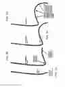 Fig. 08 - Active catheter device and associated system and method