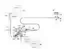 Fig. 01 - Direct stream hydrodynamic catheter system