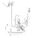 Fig. 02 - Direct stream hydrodynamic catheter system