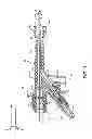 Fig. 04 - Direct stream hydrodynamic catheter system