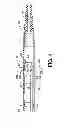 Fig. 05 - Direct stream hydrodynamic catheter system