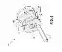 Fig. 06 - Direct stream hydrodynamic catheter system