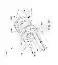 Fig. 22 - Direct stream hydrodynamic catheter system