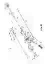 Fig. 24 - Direct stream hydrodynamic catheter system