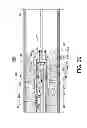 Fig. 27 - Direct stream hydrodynamic catheter system
