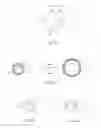 Fig. 03 - Repositionable therapy delivery element anchor