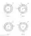 Fig. 06 - Repositionable therapy delivery element anchor