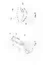 Fig. 05 - PROTECTION AND ACCOMMODATION SYSTEM, IN PARTICULAR FOR A DEVICE FOR DELIVERING A TREATMENT TO A PATIENT