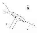 Fig. 03 - Antimicrobial barrier device