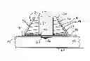 Fig. 01 - Wound barrier pad