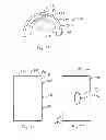 Fig. 12 - Wound barrier pad