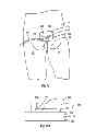 Fig. 19 - Wound barrier pad