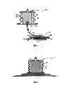Fig. 02 - Reduced pressure delivery system having a manually-activated pump for providing treatment to low-severity wounds