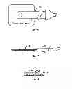 Fig. 08 - Reduced pressure delivery system having a manually-activated pump for providing treatment to low-severity wounds