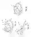 Fig. 03 - Medical device anchoring apparatus