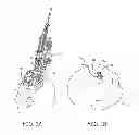 Fig. 02 - Medical device anchoring apparatus and methods