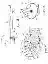 Fig. 04 - Medical device anchoring apparatus and methods